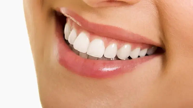 Dentist After Treatment